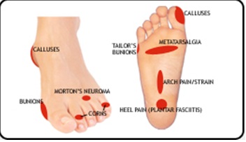 tendonitis bottom of foot