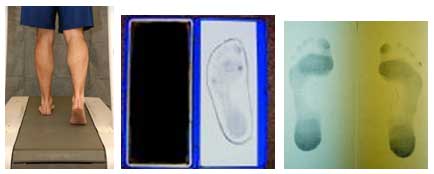 gait analysis footprints