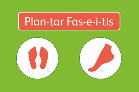 The Ultimate Guide To Plantar Fasciitis