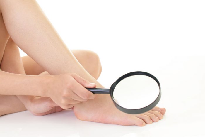 What Can Your Toenails Tell You About Your Health?