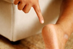 winter foot care